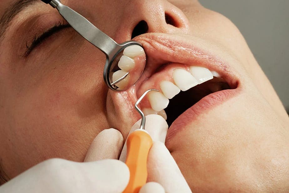 Terapia parodontale non chirurgica